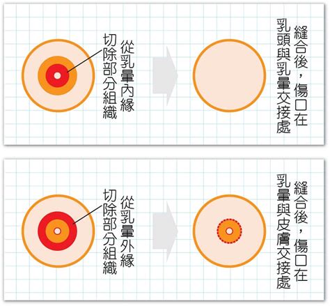 乳暈 黑點|乳暈上有「小顆粒」正常嗎？乳暈顏色和別人不一樣？女孩到女人。